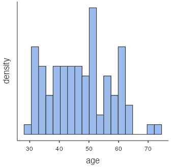 histogram - professor ages